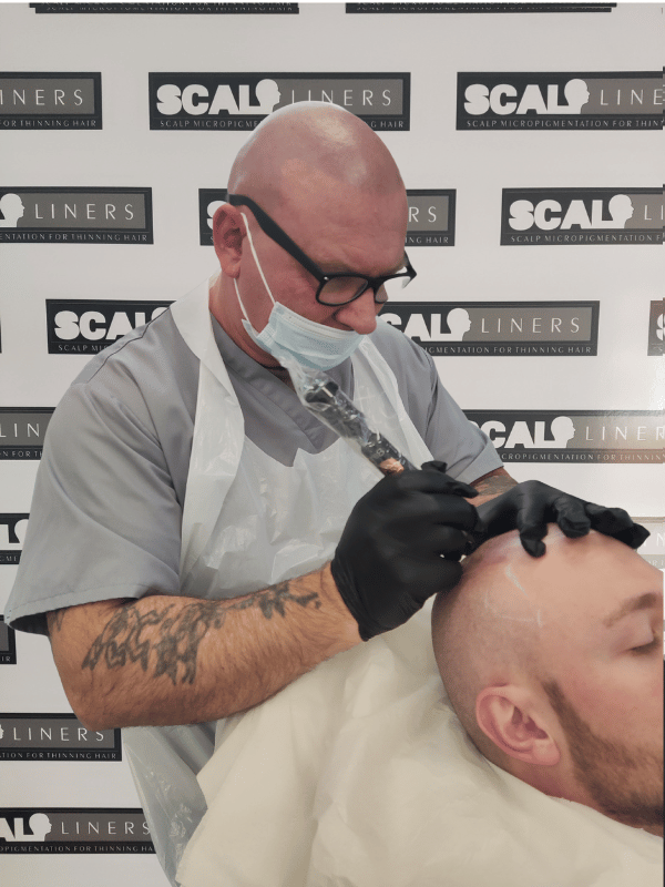 Advanced SMP treatment for natural hair density in Kent