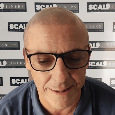 scalpliners-smp-testimonial